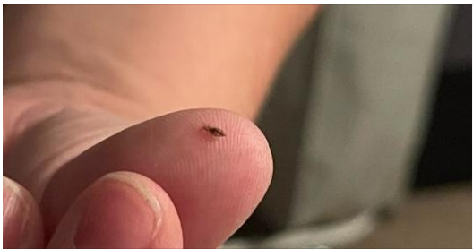 How to keep head lice away from children (and adults!)