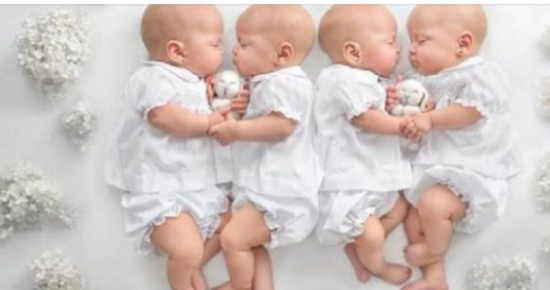 After 14 years, the woman delivered quadruplets who are identical to each other: Here’s how the girls appear now