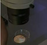 Old Frozen Embryo Develops New Baby