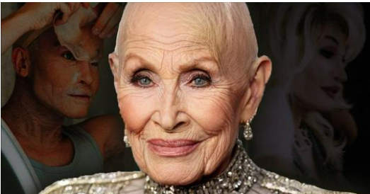 Dolly Parton Tried to Keep Her Disease a Secret, Now We Know