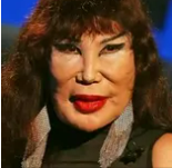 She Was A Famous Actress Who Appeared In Around 100 Films, But One Tragic Mistake Drastically Altered Her Appearance 