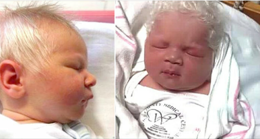 Baby boy born with snow-white hair dubbed Prince Charming