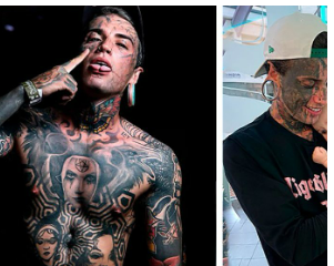 He is better without them!A 24-year-old father, who has several tattoos all over his body, makes the decision to get them erased for his child