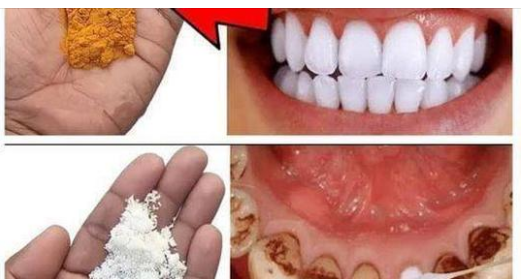 Natural Remedies for a Brighter Smile