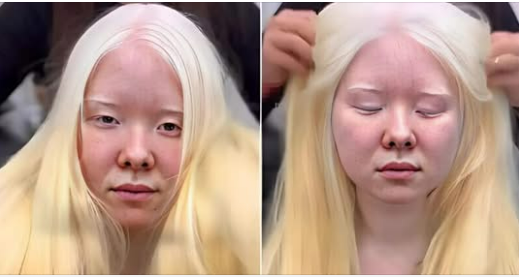 This Albino Girl Revealed Her New Brunette Look