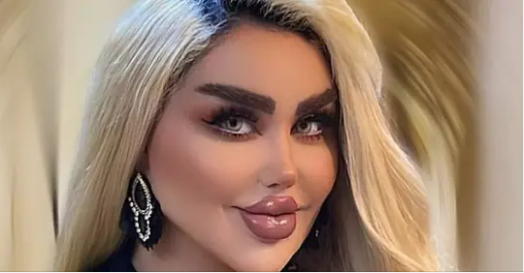 Woman’s 43 operations to look like Barbie backfire
