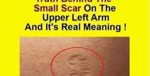 Do you know the true meaning of the little scar?